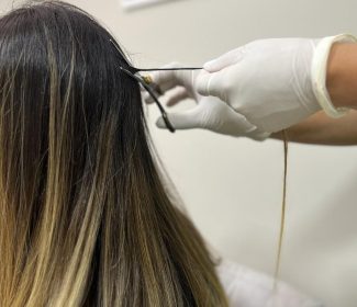 corte mecha para exame de tricologia digital