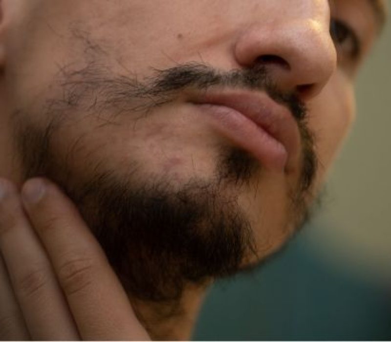 4 soluções para corrigir barba falhada