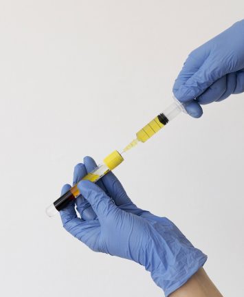 PRP Capilar (Plasma Rico em Plaquetas)